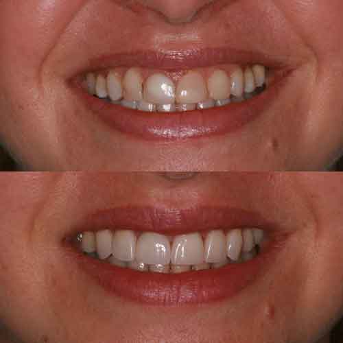 cosmetica_dentale_1