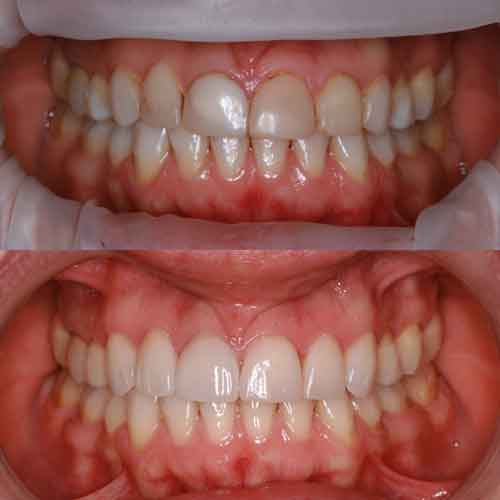 cosmetica_dentale_2