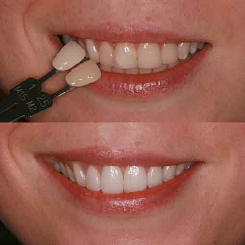 cosmetica_dentale_3