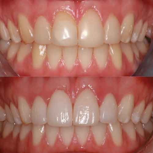 cosmetica_dentale_4